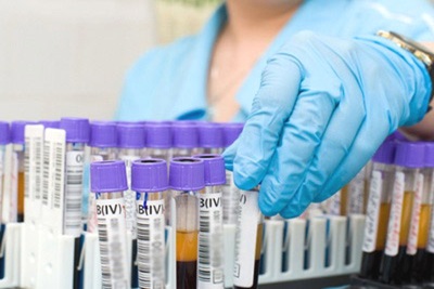 Close up female doctor hands with blood testing tube isolated on gray background
