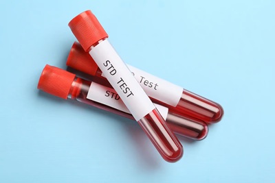 Close up female doctor hands with blood testing tube isolated on gray background
