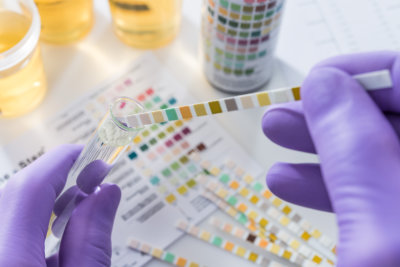 urine test strips in purple gloves